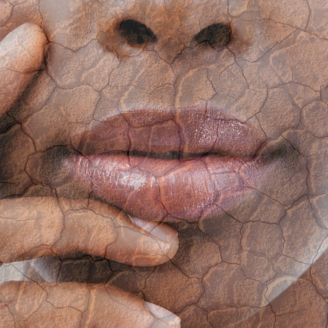 CHAPPED FOREVERMORE? | THE BEST 5 WAYS TO MAINTAIN LUSCIOUS LIPS